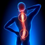 Douleurs dorsales : douleurs de cotes, TOS, Scoliose, névralgie intercostale, fibromialgie, …